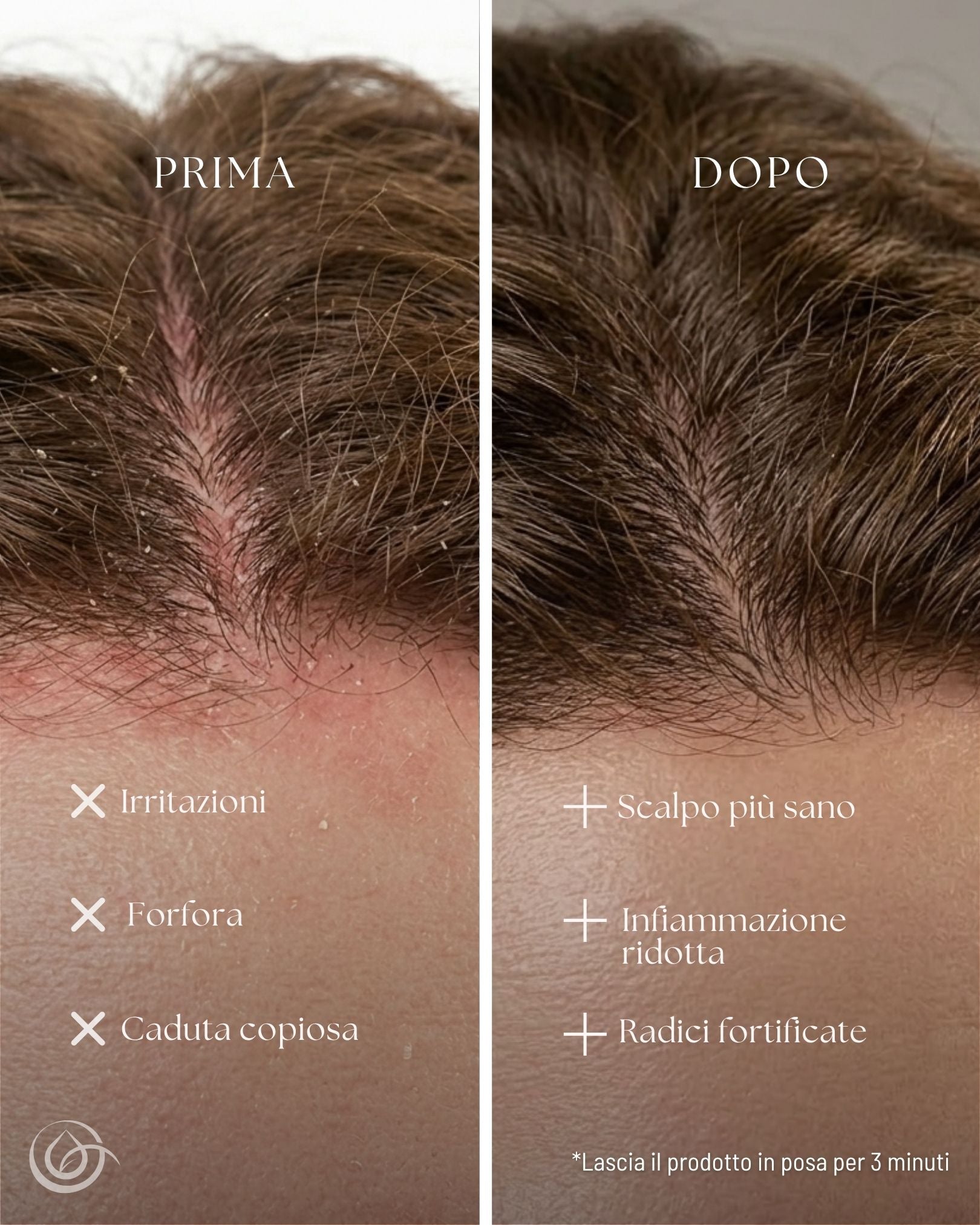Shampoo Rinforzante all'olio di Neem, Ortica e Fieno Greco