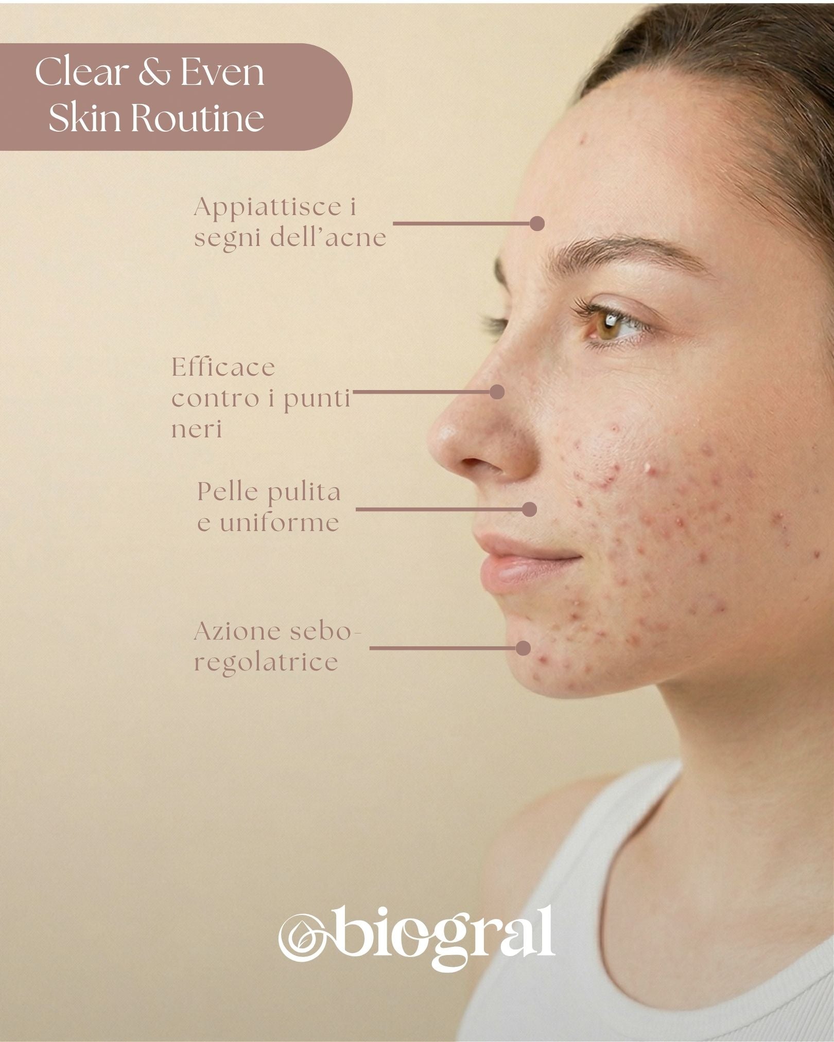 Clear & Even Skin Routine