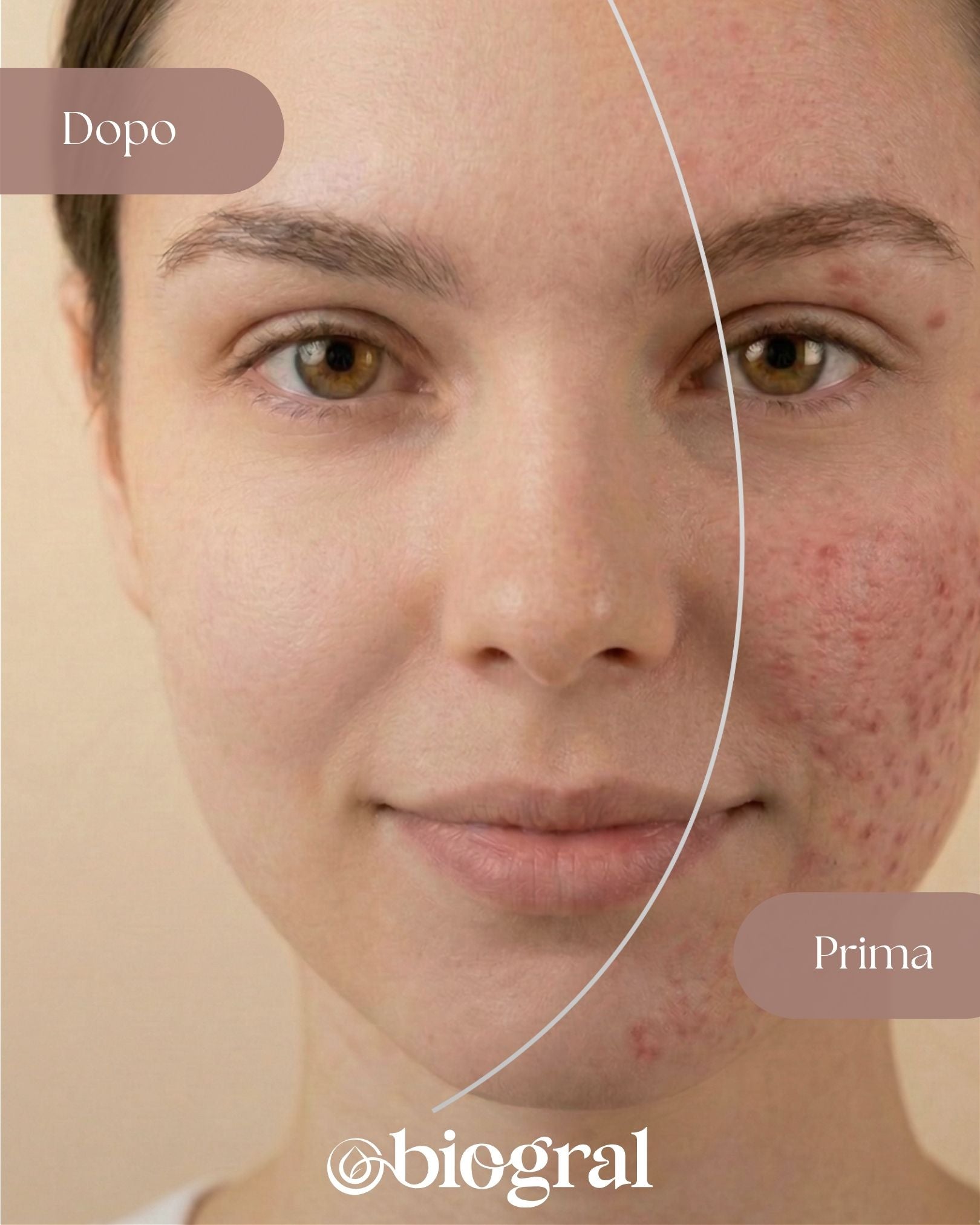 Clear & Even Skin Routine